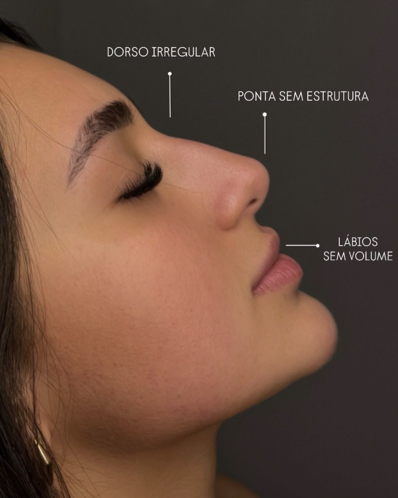 Mini Full Face (antes)